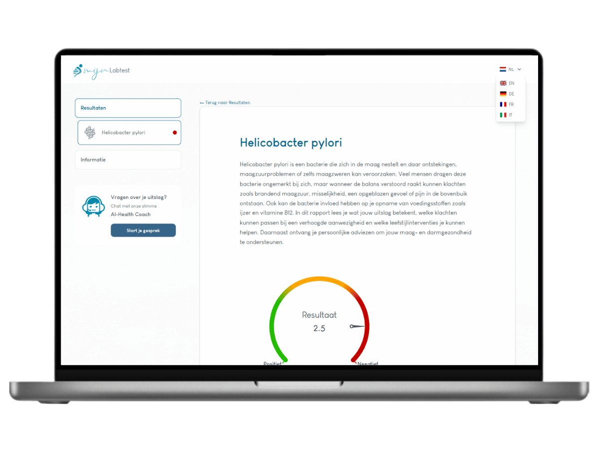 Zo ziet het resultaat van jouw Helicobacter pylori test er uit. Het is het meest complete rapport met AI integratie en leefstijl advies. Zo ziet het resultaat van jouw Helicobacter pylori test er uit. Het is het meest complete rapport met AI integratie en leefstijl advies.