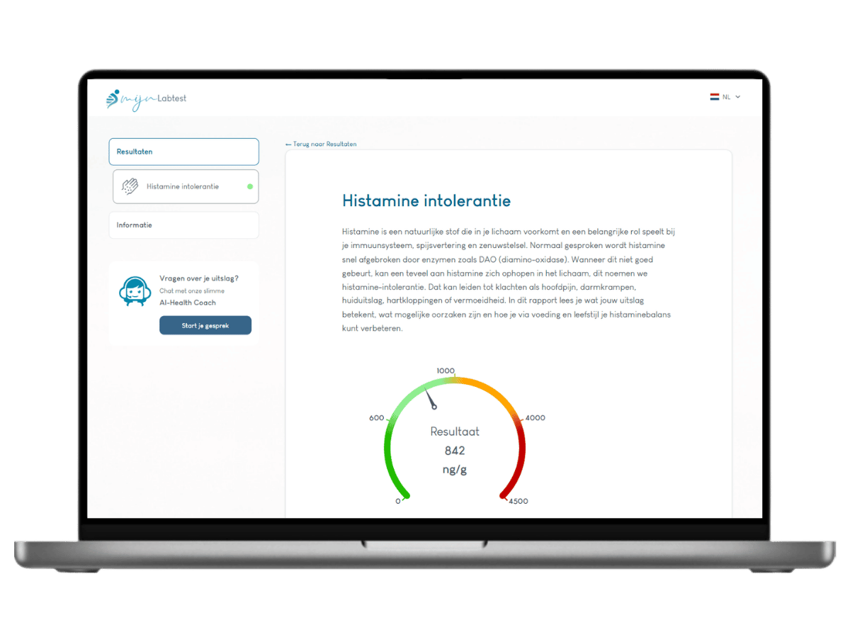 Binnen 10 werkdagen jouw persoonlijke uitslag via een beveiligde email.