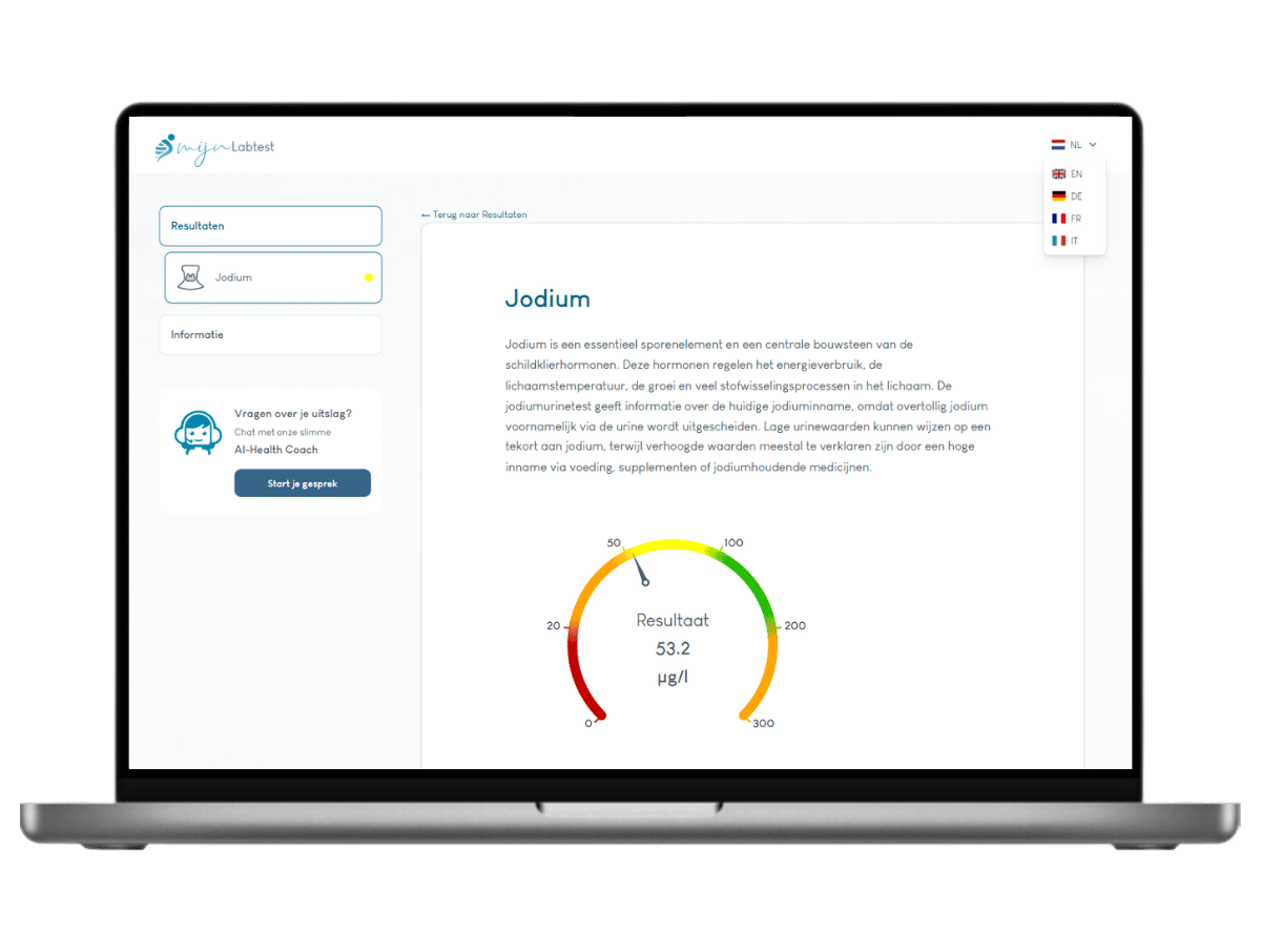 De uitslag met jouw jodium waarde