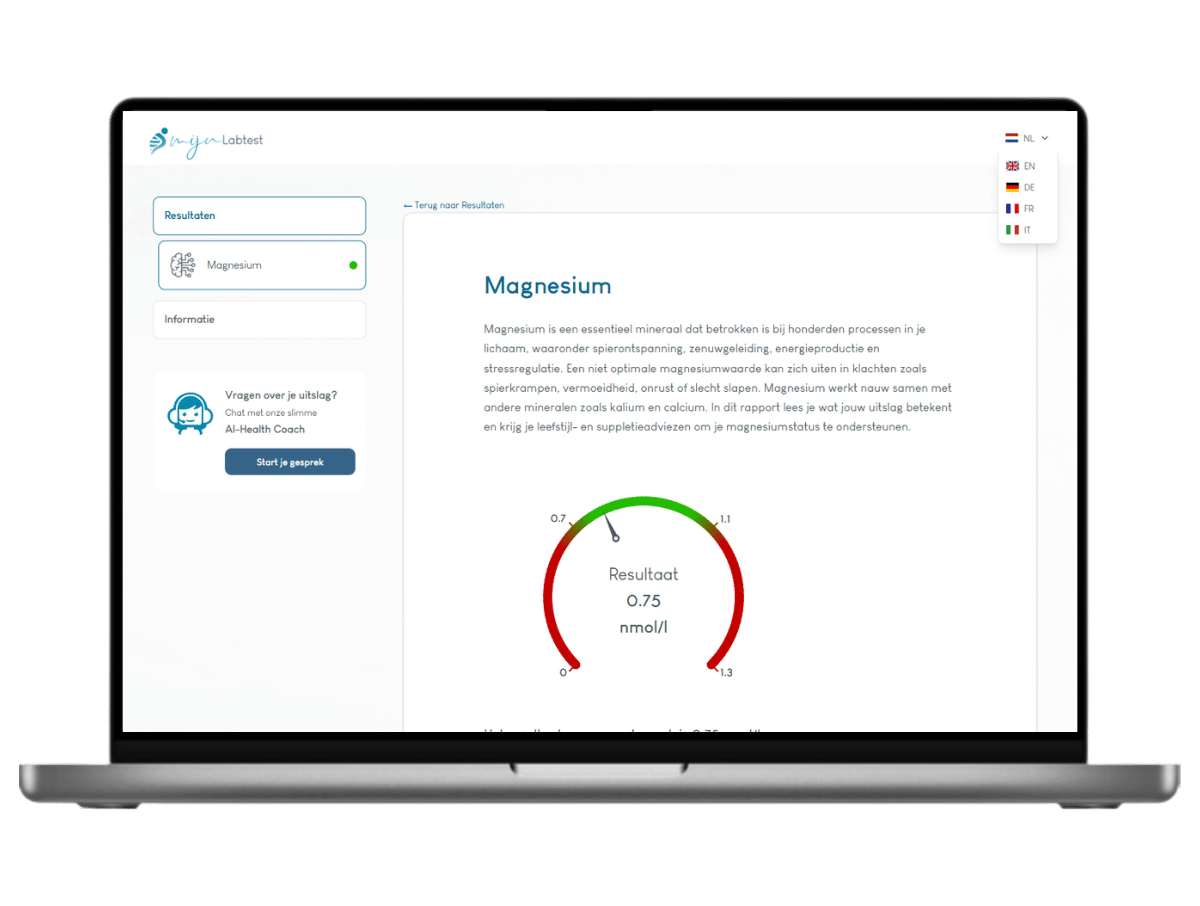 Voorbeeldrapport bloedtest magnesium tekort - Na de test kun je direct aan de slag met uitleg en tips uit het rapport Voorbeeldrapport bloedtest magnesium tekort - Na de test kun je direct aan de slag met uitleg en tips uit het rapport