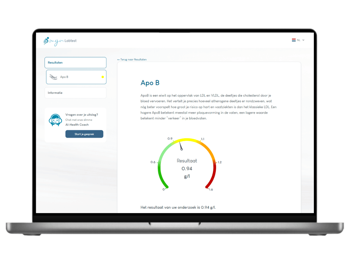 Zo ziet het resultaat van jouw ApoB resultaat er uit. Zo ziet het resultaat van jouw ApoB resultaat er uit.