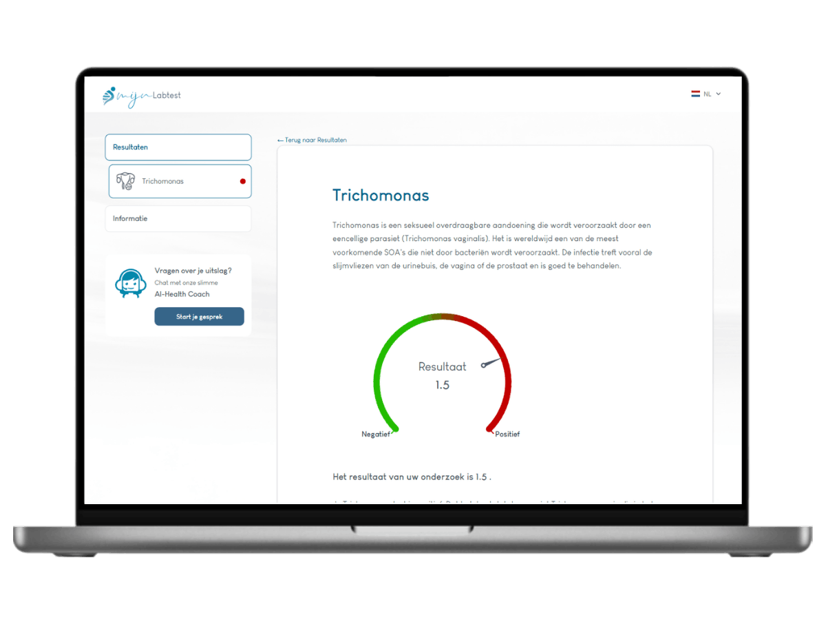 Overzicht Trichomonas test