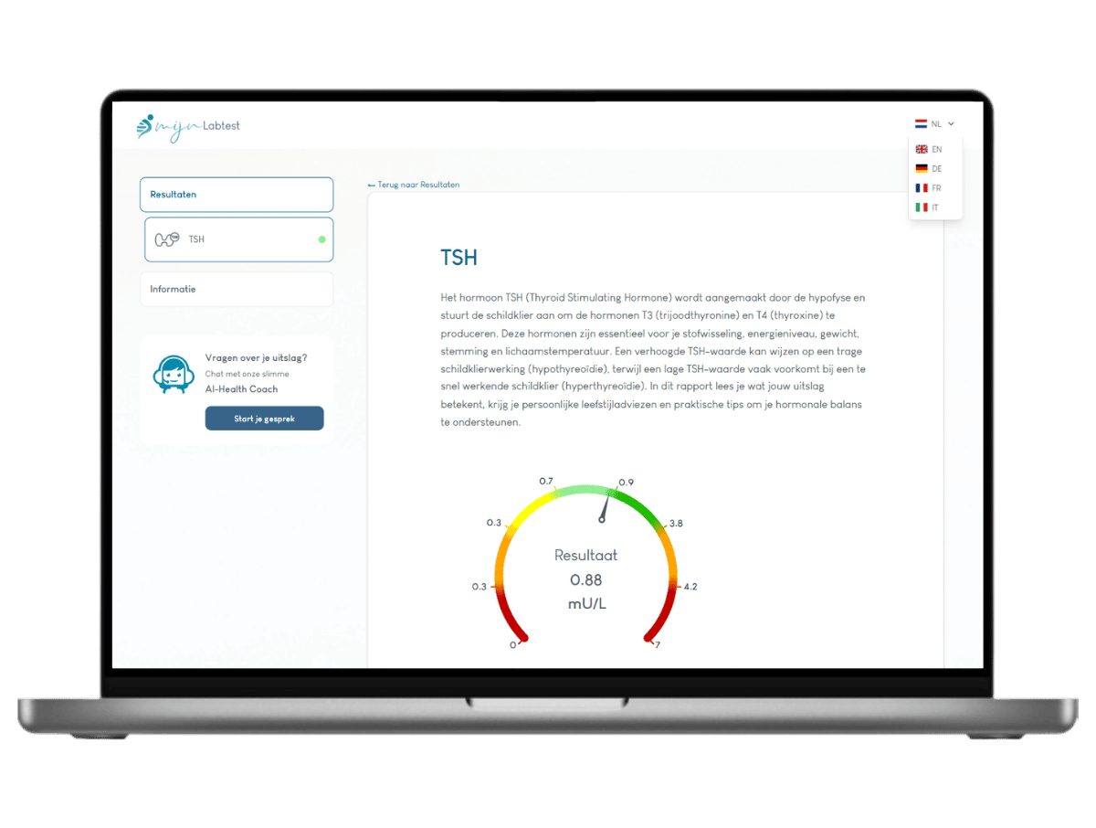 Zo ziet het resultaat van jouw TSH test eruit uit. Het is het meest complete rapport met AI integratie en leefstijl advies.
Zo ziet het resultaat van jouw TSH test eruit uit. Het is het meest complete rapport met AI integratie en leefstijl advies.