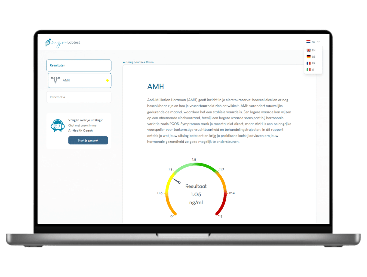 zo ziet je resultaat er uit zo ziet je resultaat er uit
