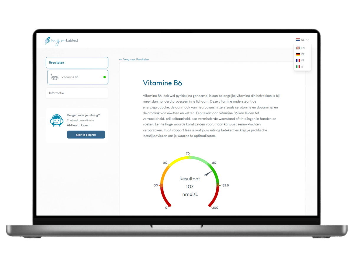 Zo ziet jouw vitamine B6 test resultaat eruit
