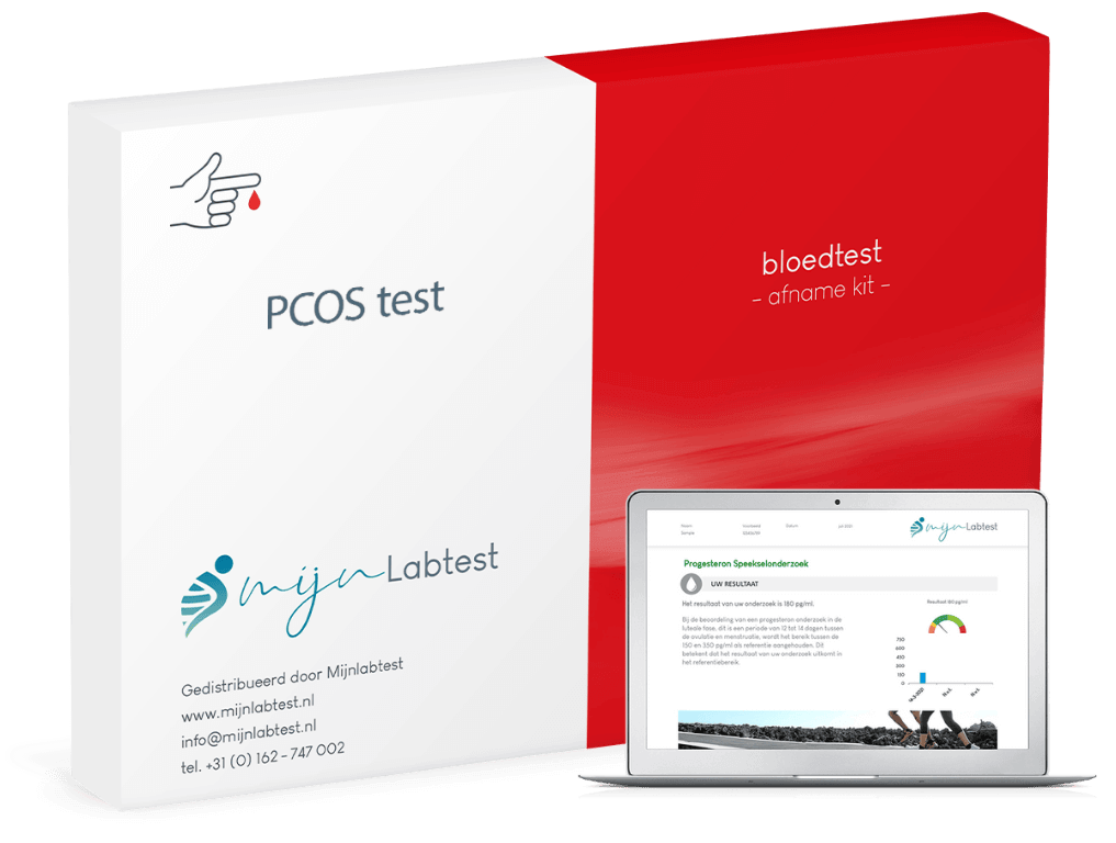 Dit is de afnamekit om de pcos test goed uit te kunnen voeren