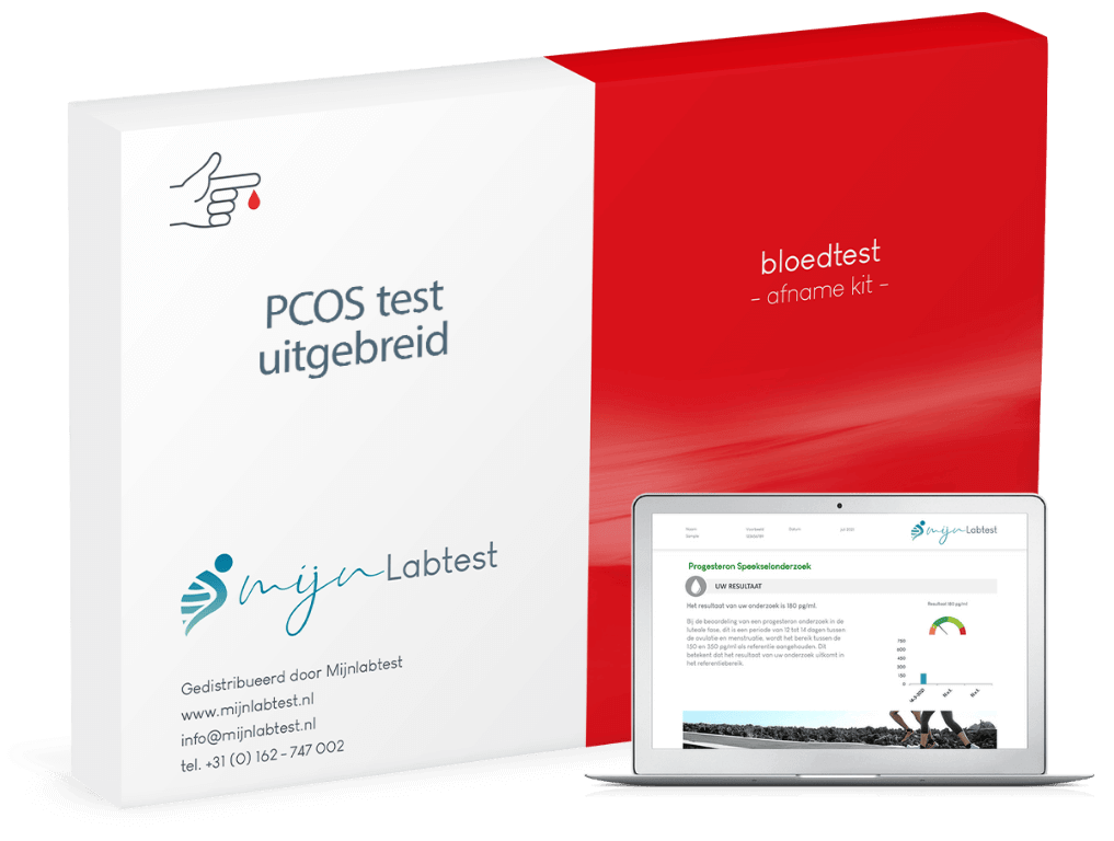 Dit is de meest uitgebreide pcos test