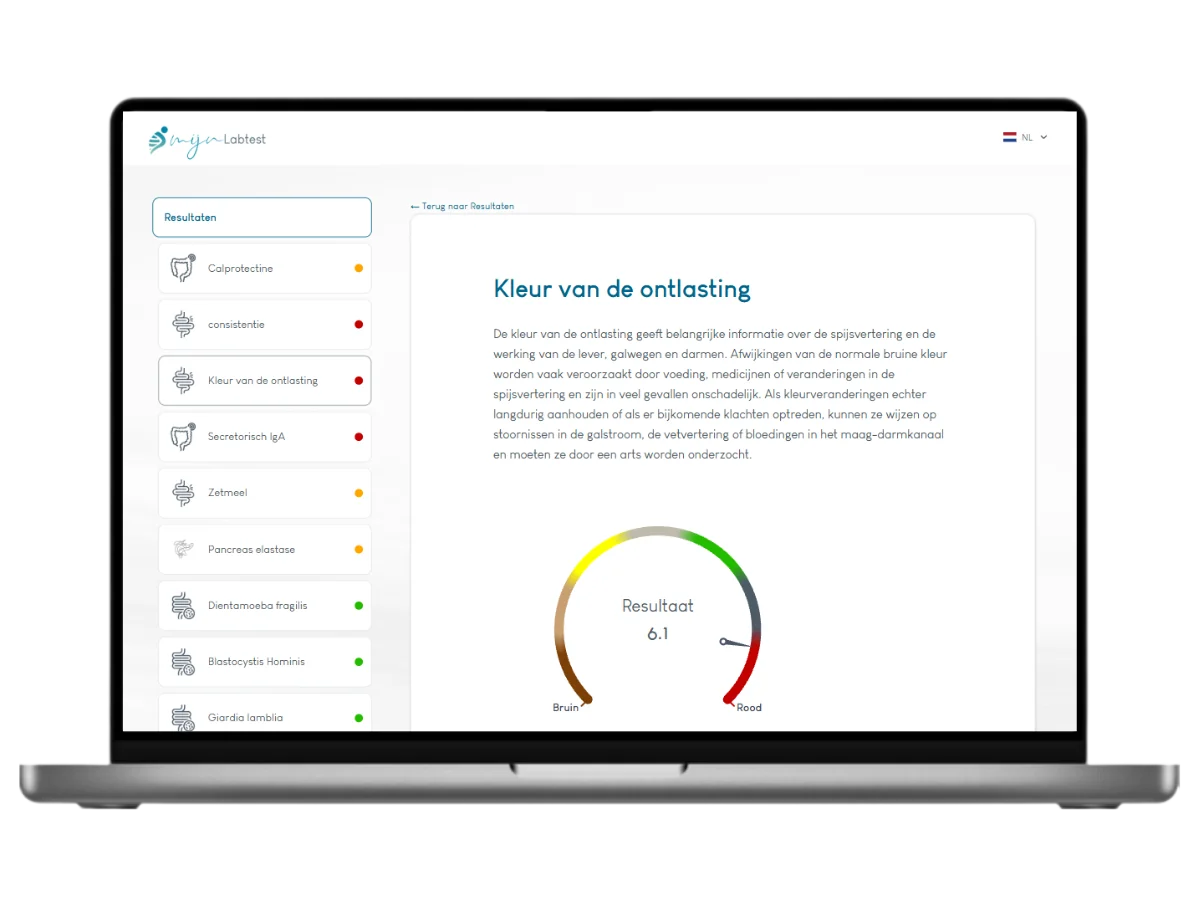 Het resultaat kleur van de ontlasting is onderdeel van jouw PDS darmtest.