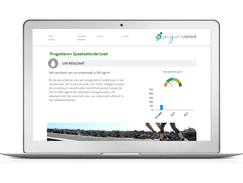 Het resultaat van je pcos test