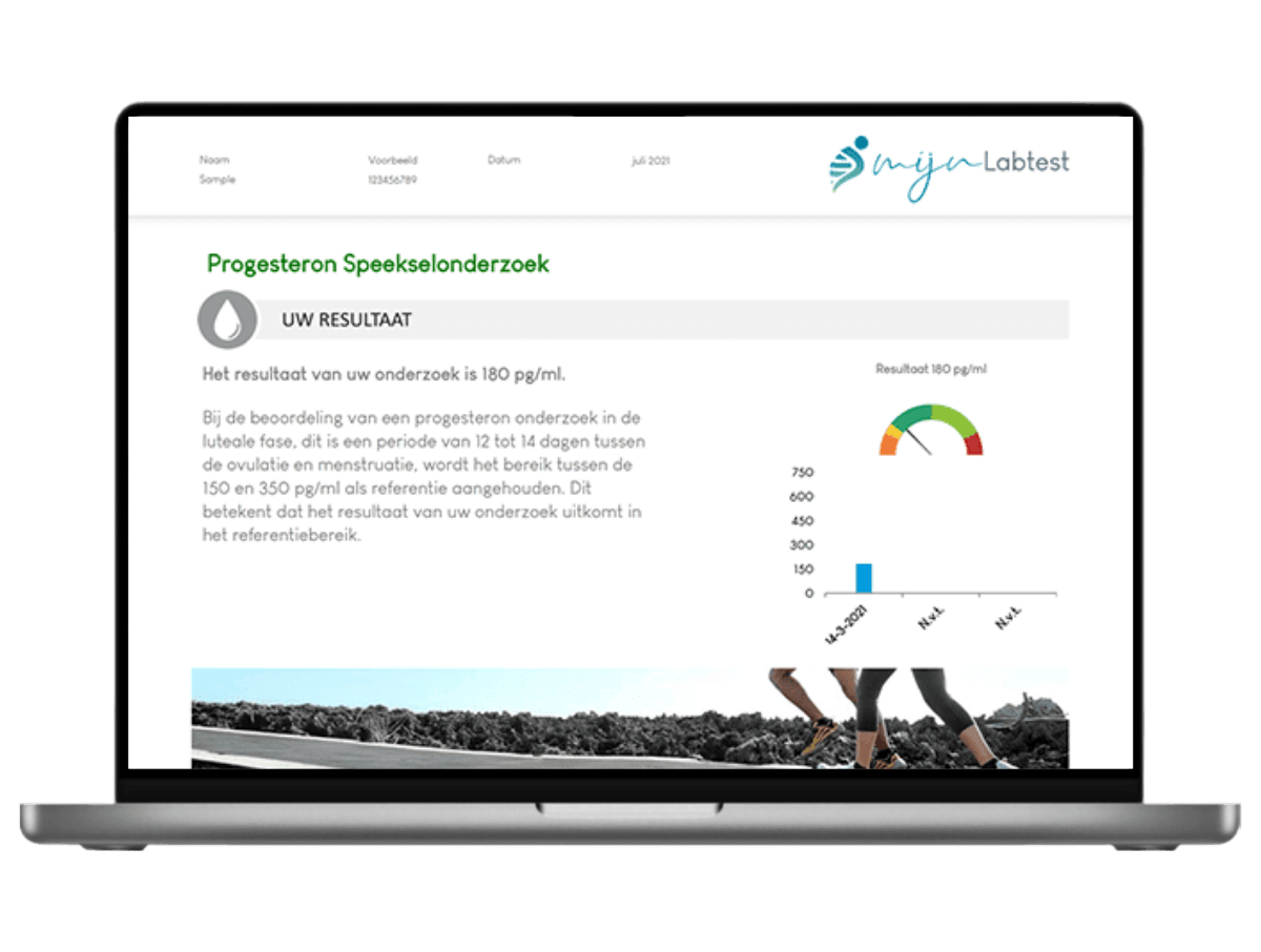 Progesteron speekselonderzoek vrouw Progesteron speekselonderzoek vrouw