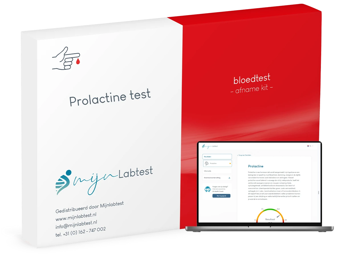 Prolactine test