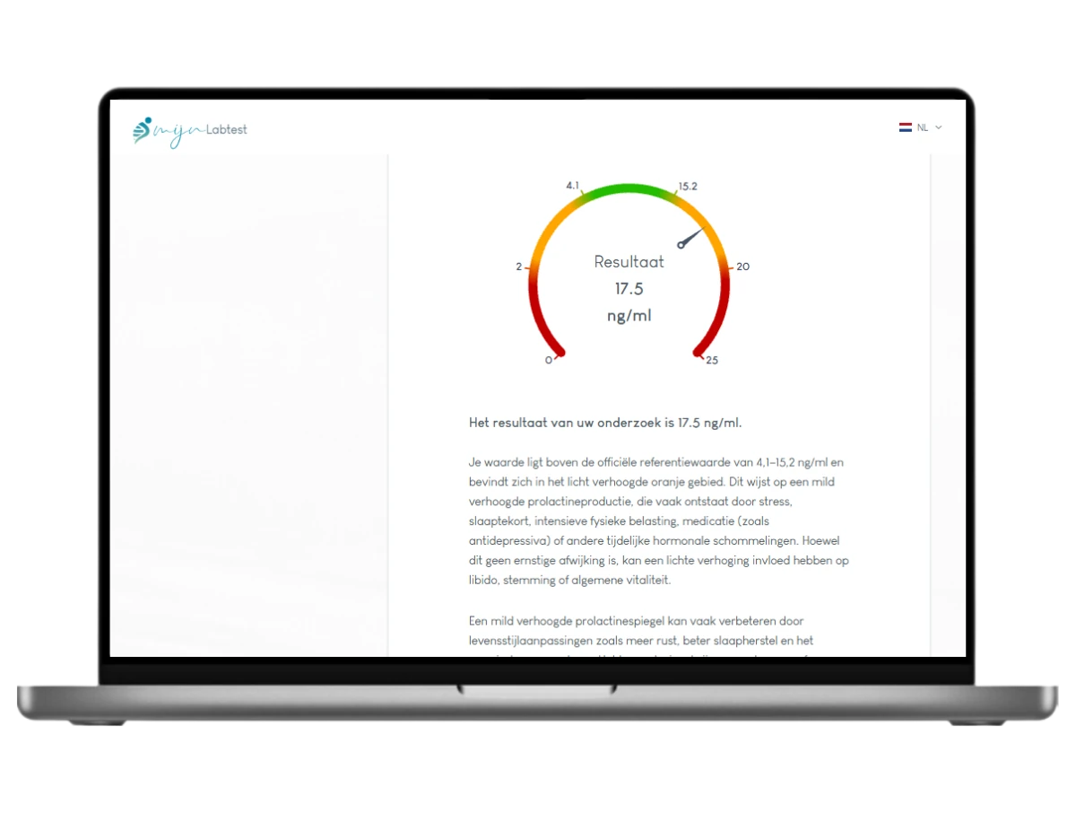 Het resultaat van jouw Prolactine test. ontvang je resultaat na 4 werkdagen
