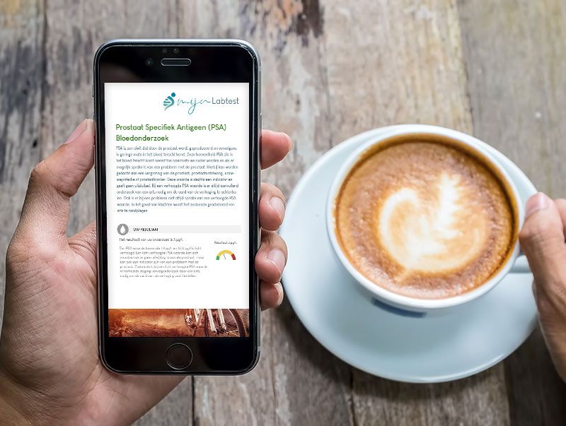 De uitslag van het zelftest PSA is eenvoudig af te lezen vanaf elk device.