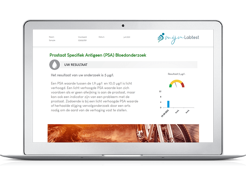 Voorbeeldrapport PSA zelftest - Na de test kun je direct aan de slag met uitleg en tips uit het rapport 