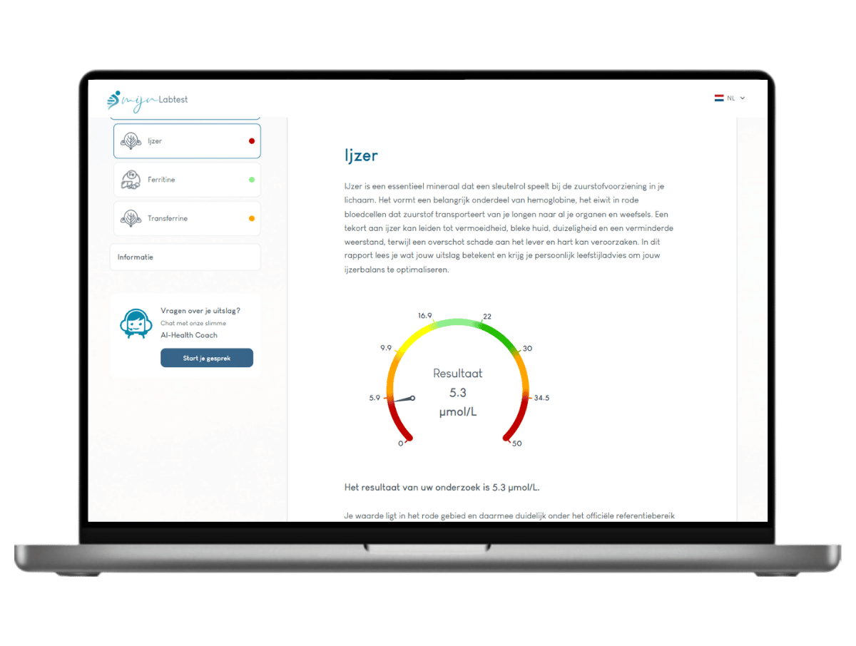 Zo ziet het resultaat van jouw ijzertekort test er uit. Het meest complete rapport met AI integratie en leefstijl advies. Zo ziet het resultaat van jouw ijzertekort test er uit. Het meest complete rapport met AI integratie en leefstijl advies.