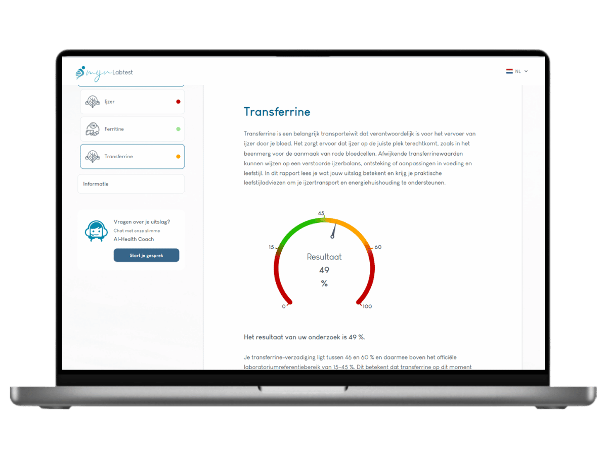 Het meest complete rapport met AI integratie en leefstijl advies. Het meest complete rapport met AI integratie en leefstijl advies.