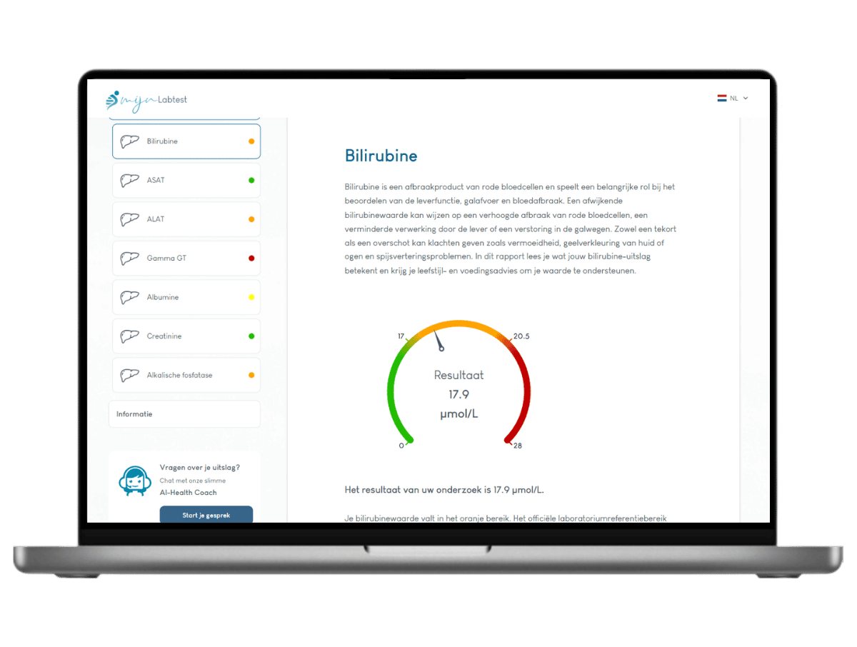Bilirubine resultaat Bilirubine resultaat