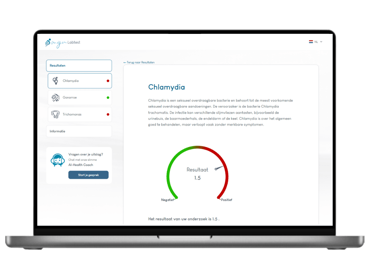 Jouw persoonlijke chlamydia resultaat getest vanuit huis Jouw persoonlijke chlamydia resultaat getest vanuit huis