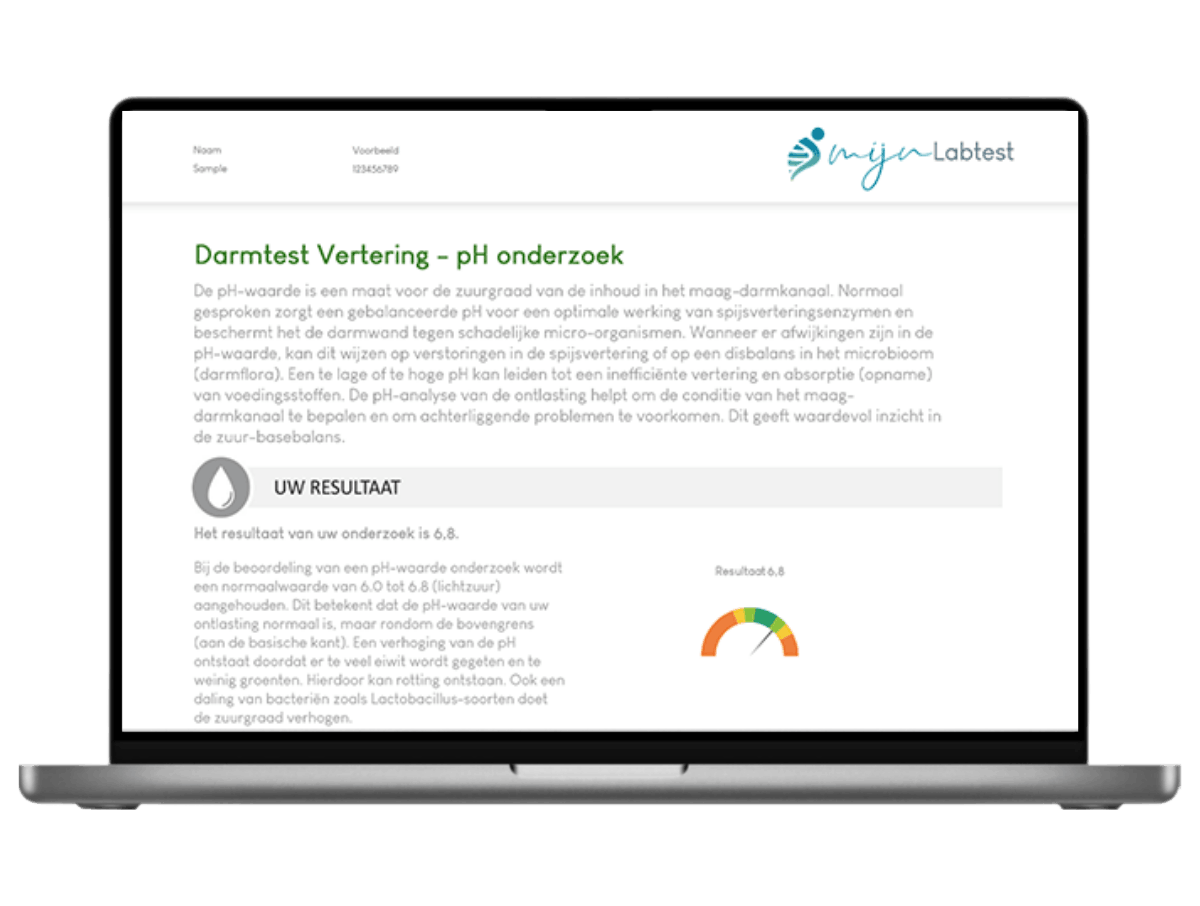 Bekijk het resultaat van je spijsverteringstest eenvoudig op je mobiel. 