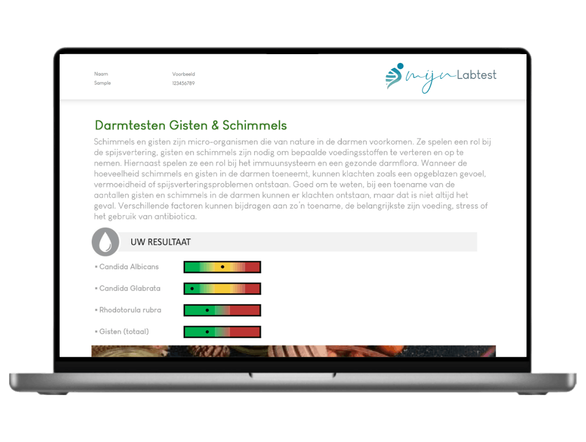 Zo ziet jouw gisten en schimmels test resultaat er uit. Zo ziet jouw gisten en schimmels test resultaat er uit.