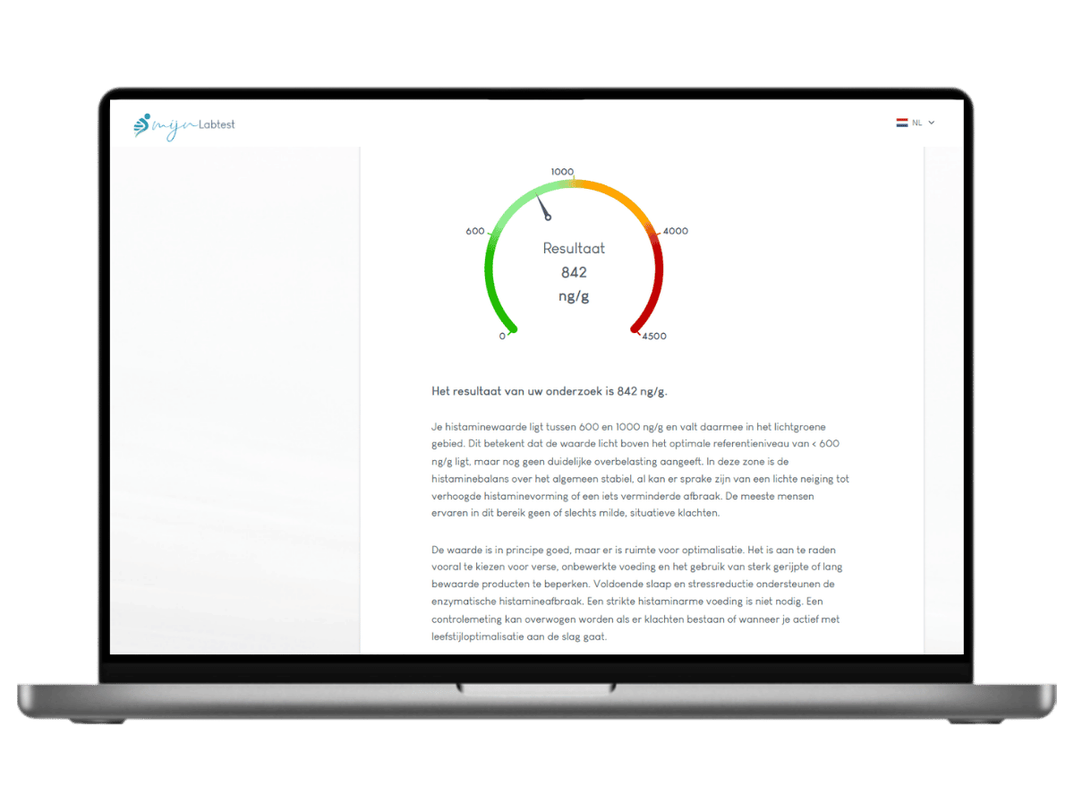 Inhoud van jouw resultaat inclusief leefstijl en voedingsadvies.