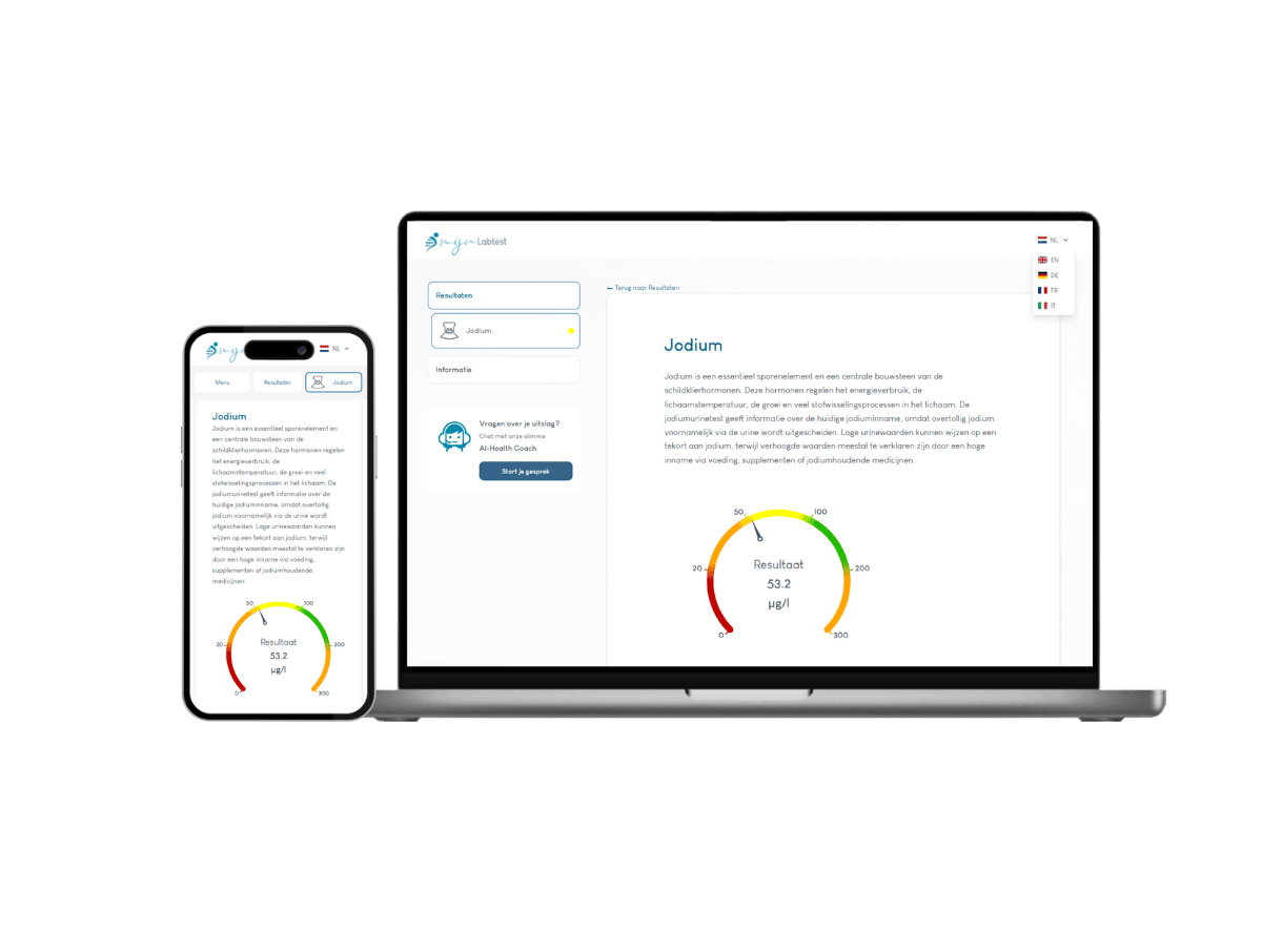 Zo ziet het resultaat van jouw Jodium urinetest er uit. Het is het meest complete rapport met AI integratie en leefstijl advies. Zo ziet het resultaat van jouw Jodium urinetest er uit. Het is het meest complete rapport met AI integratie en leefstijl advies.