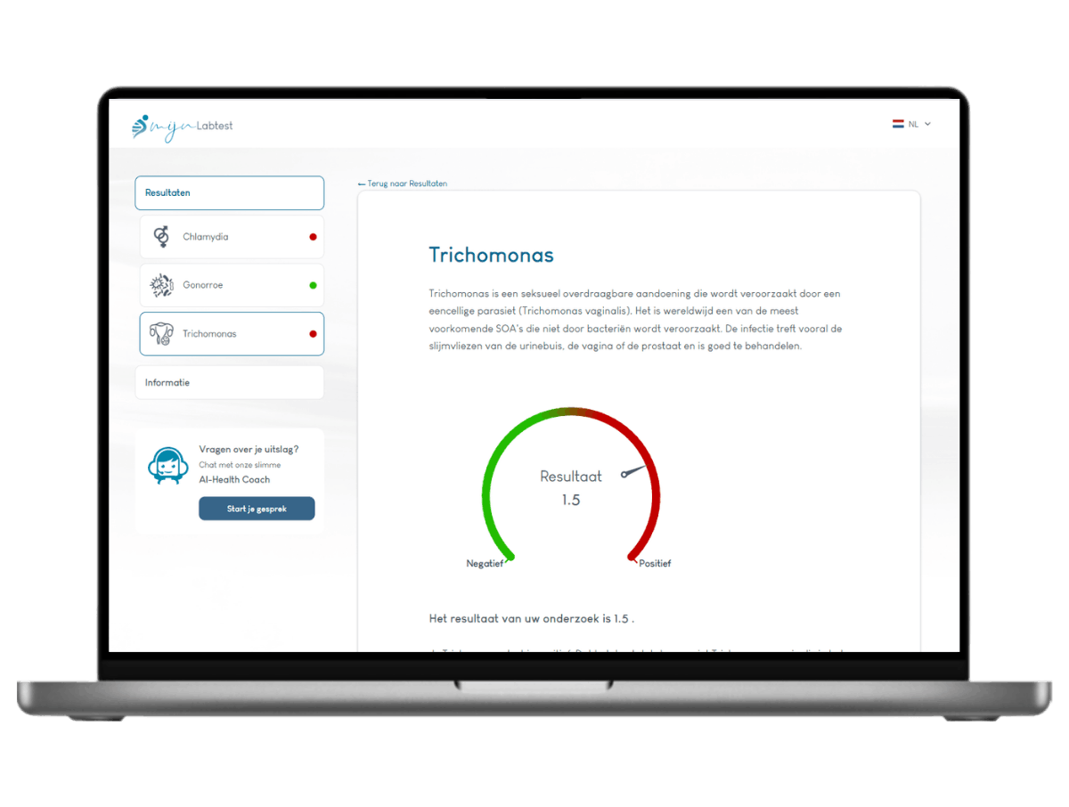 Jouw persoonlijke trichomonas resultaat Jouw persoonlijke trichomonas resultaat