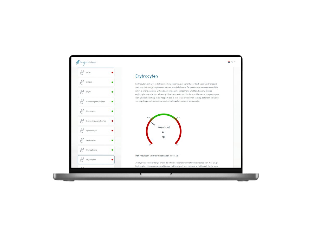Dit is hoe jouw Erytrocten uitslag, onderdeel van volledig bloedbeeld er uit ziet.
