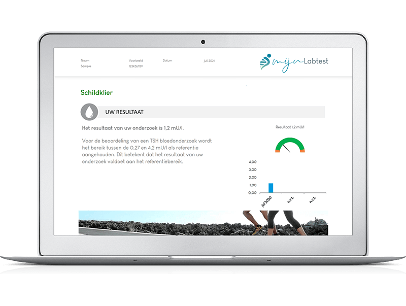 Snel en eenvoudig inzicht in je gezondheid met de totaal profiel XL bloedtest 