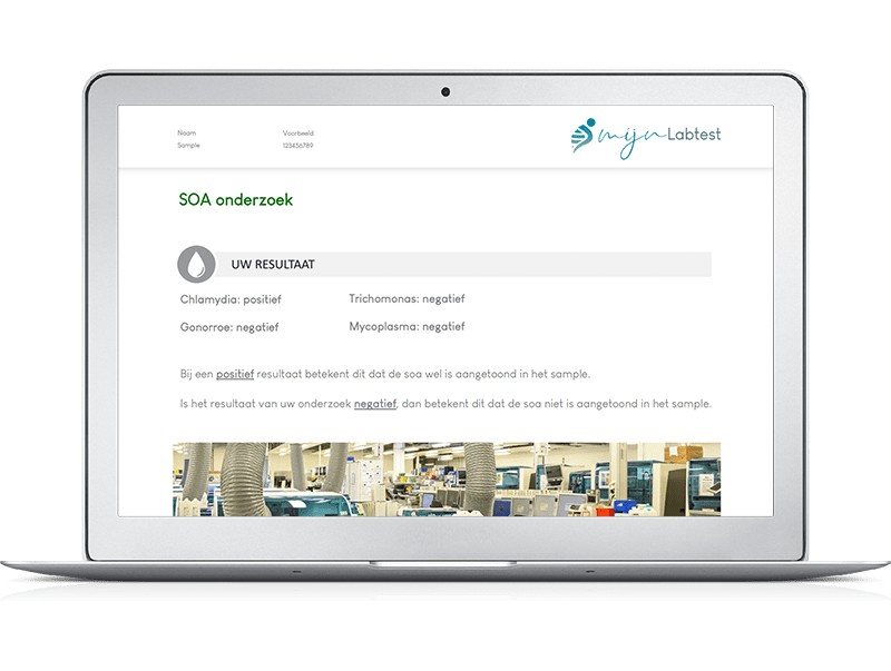 Het resultaat van een soa test