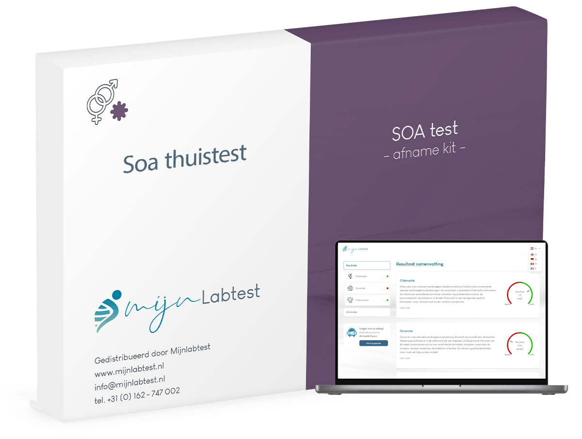 Zo ziet de verpakking van jouw soa test thuis eruit