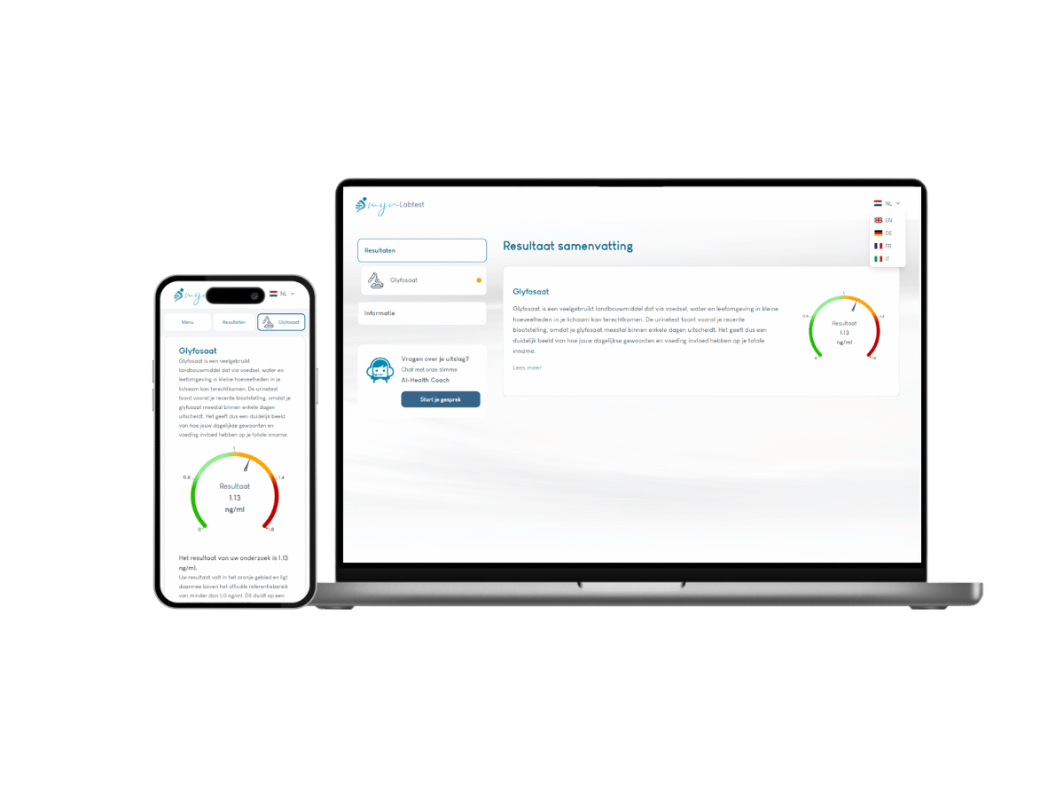 Het resultaat is zowel op jouw laptop beschikbaar als jouw telefoon. Het resultaat is zowel op jouw laptop beschikbaar als jouw telefoon.