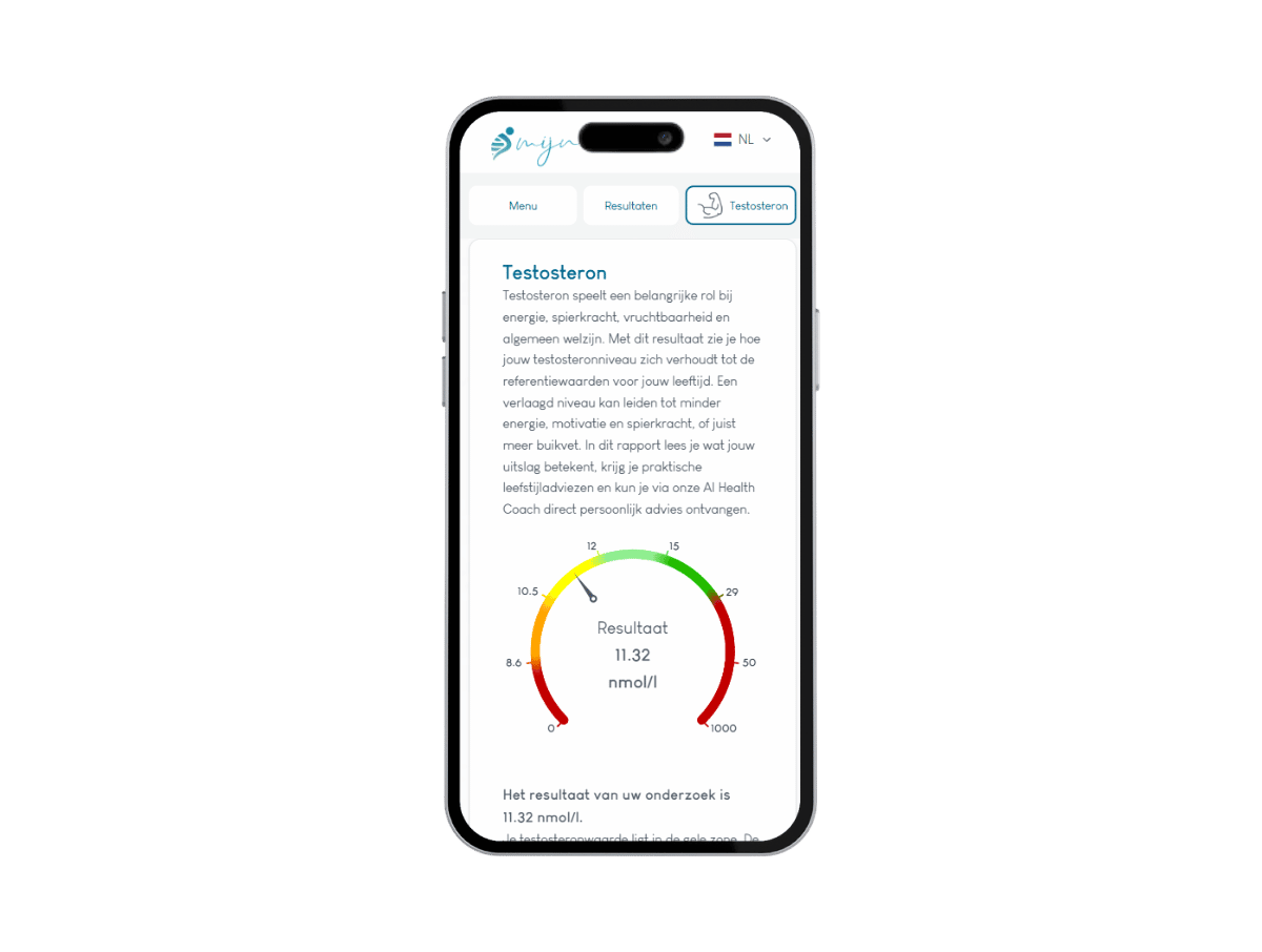 Zo ziet het resultaat van jouw testosteron test er uit. Het is het meest complete rapport met AI integratie en leefstijl advies. Zo ziet het resultaat van jouw testosteron test er uit. Het is het meest complete rapport met AI integratie en leefstijl advies.