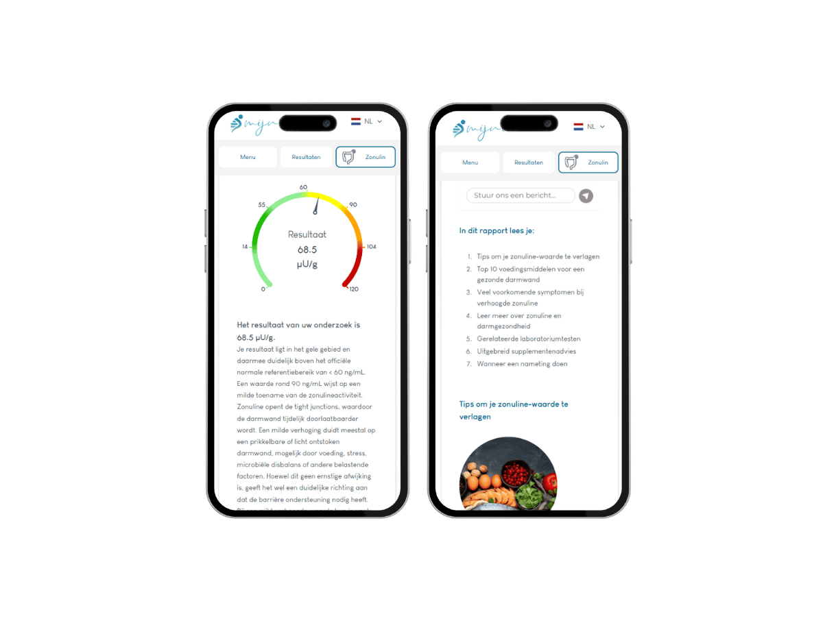 sfeerbeeld van hoe je zonuline test uitslag er op GSM uit ziet sfeerbeeld van hoe je zonuline test uitslag er op GSM uit ziet