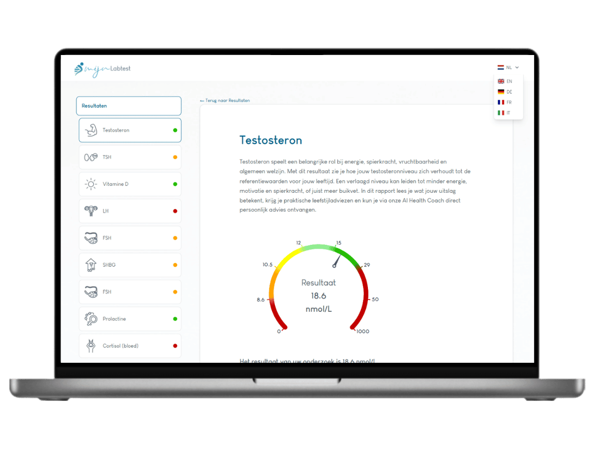 zo ziet het resultaat van je testosteron er uit. Het meest complete rapport met AI integratie en leefstijl advies. zo ziet het resultaat van je testosteron er uit. Het meest complete rapport met AI integratie en leefstijl advies.