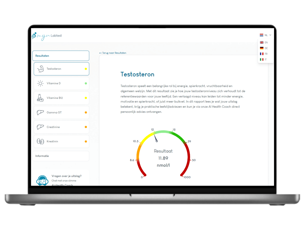 Zo ziet jouw testosteron resultaat eruit Zo ziet jouw testosteron resultaat eruit