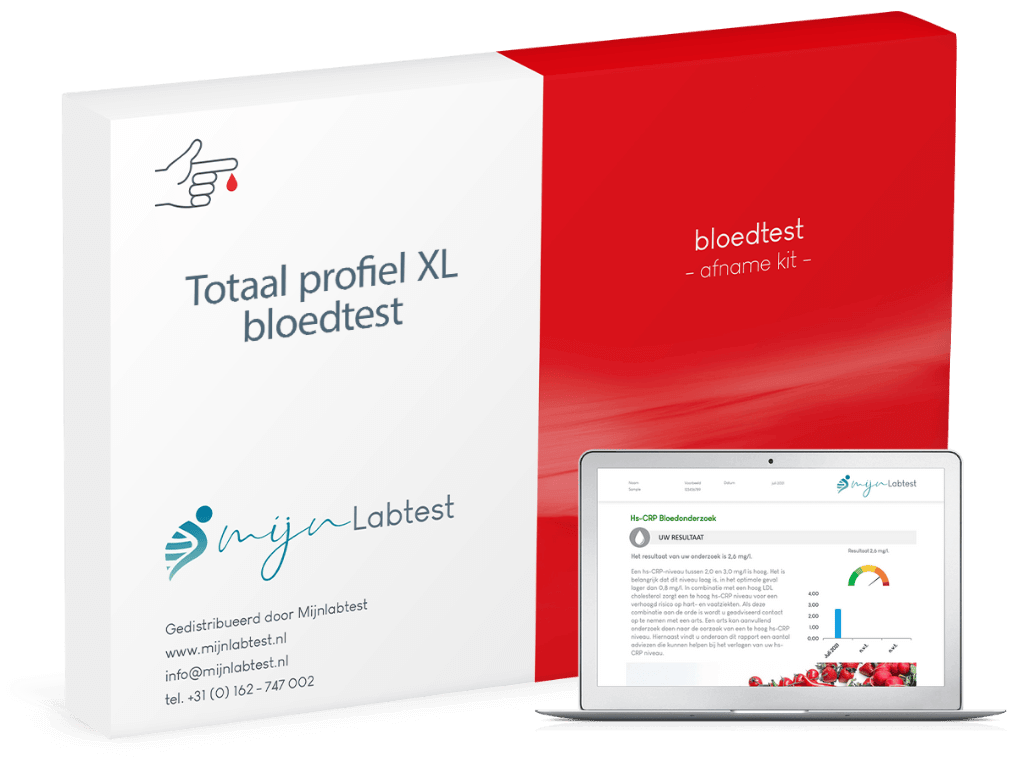 het totaal profiel XL bloedonderzoek wordt afgenomen met een eenvoudige test kit die we naar je thuisadres opsturen