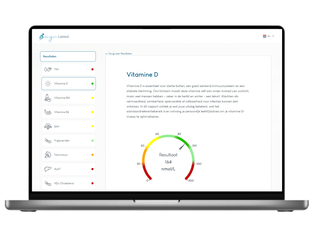 Dit is een voorbeeld van jouw Vitamine D bloedtest uitslag die verwerkt zit in de complete Totaal profiel XL bloedtest.