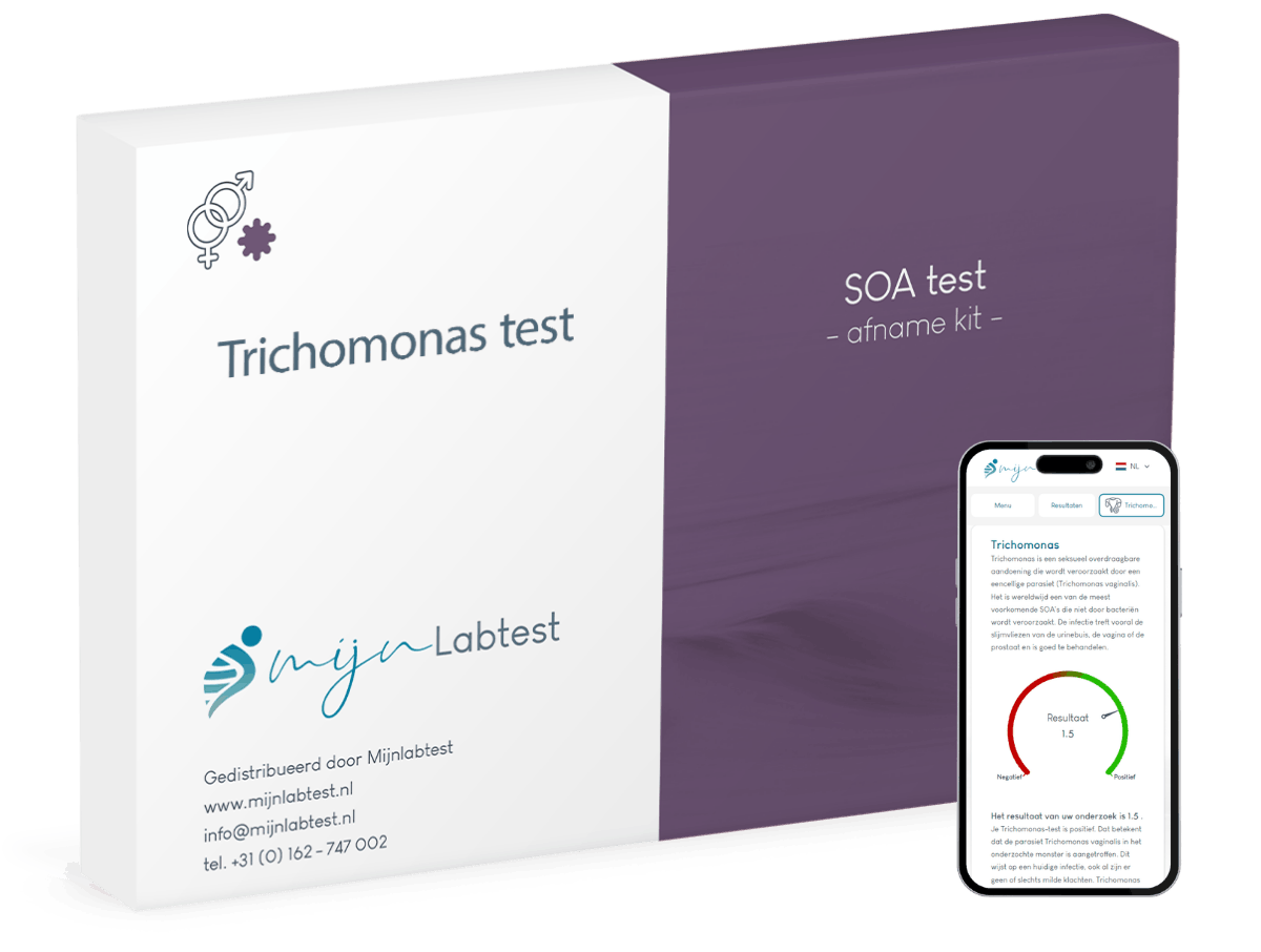 Trichomonas test Trichomonas test