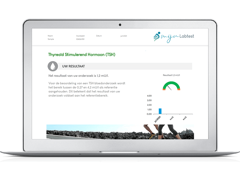 TSH test uitslag, onderdeel van hormoon test man