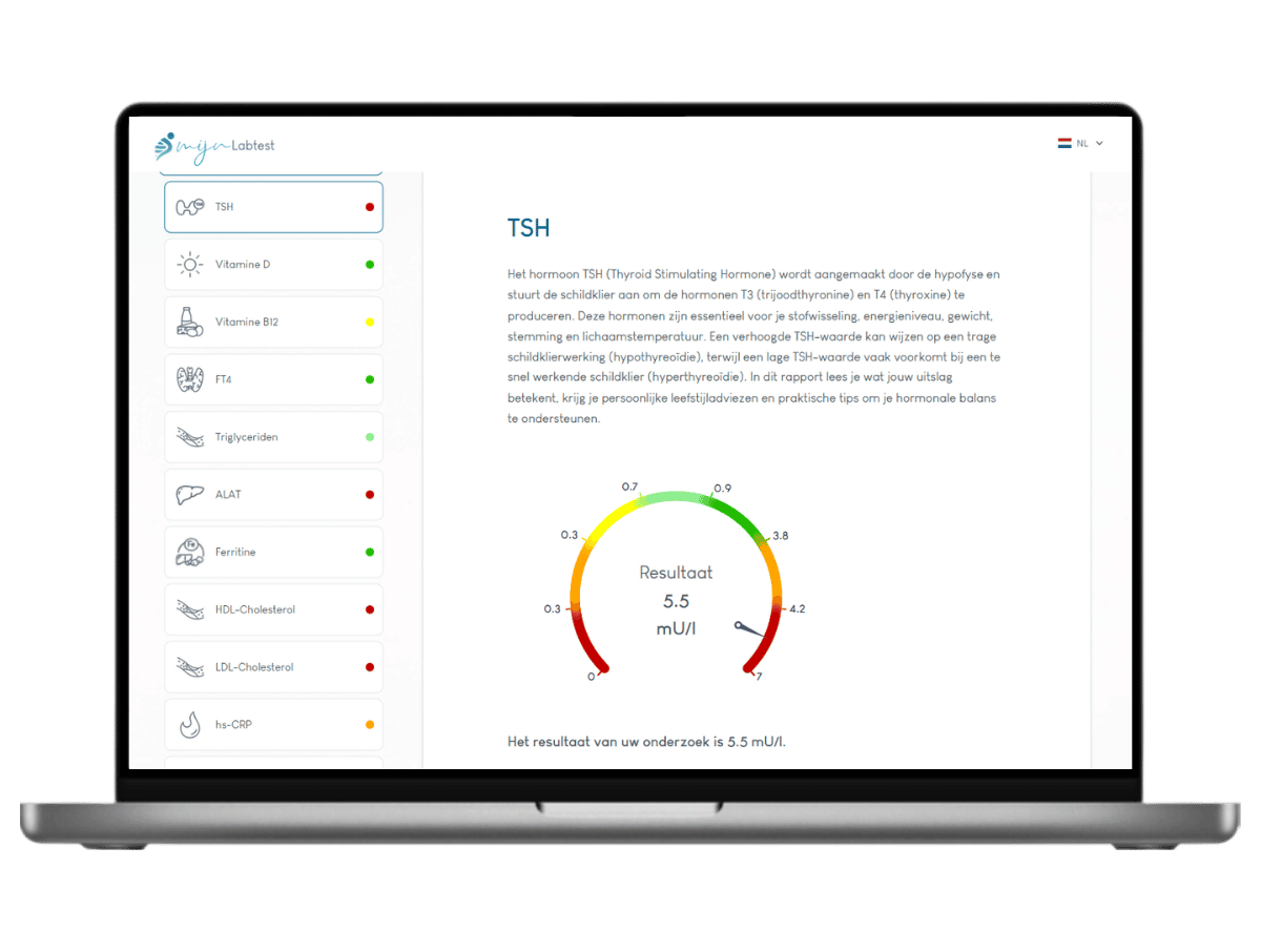 TSH resultaat. inclusief AI intergratie en leefstijladvies TSH resultaat. inclusief AI intergratie en leefstijladvies