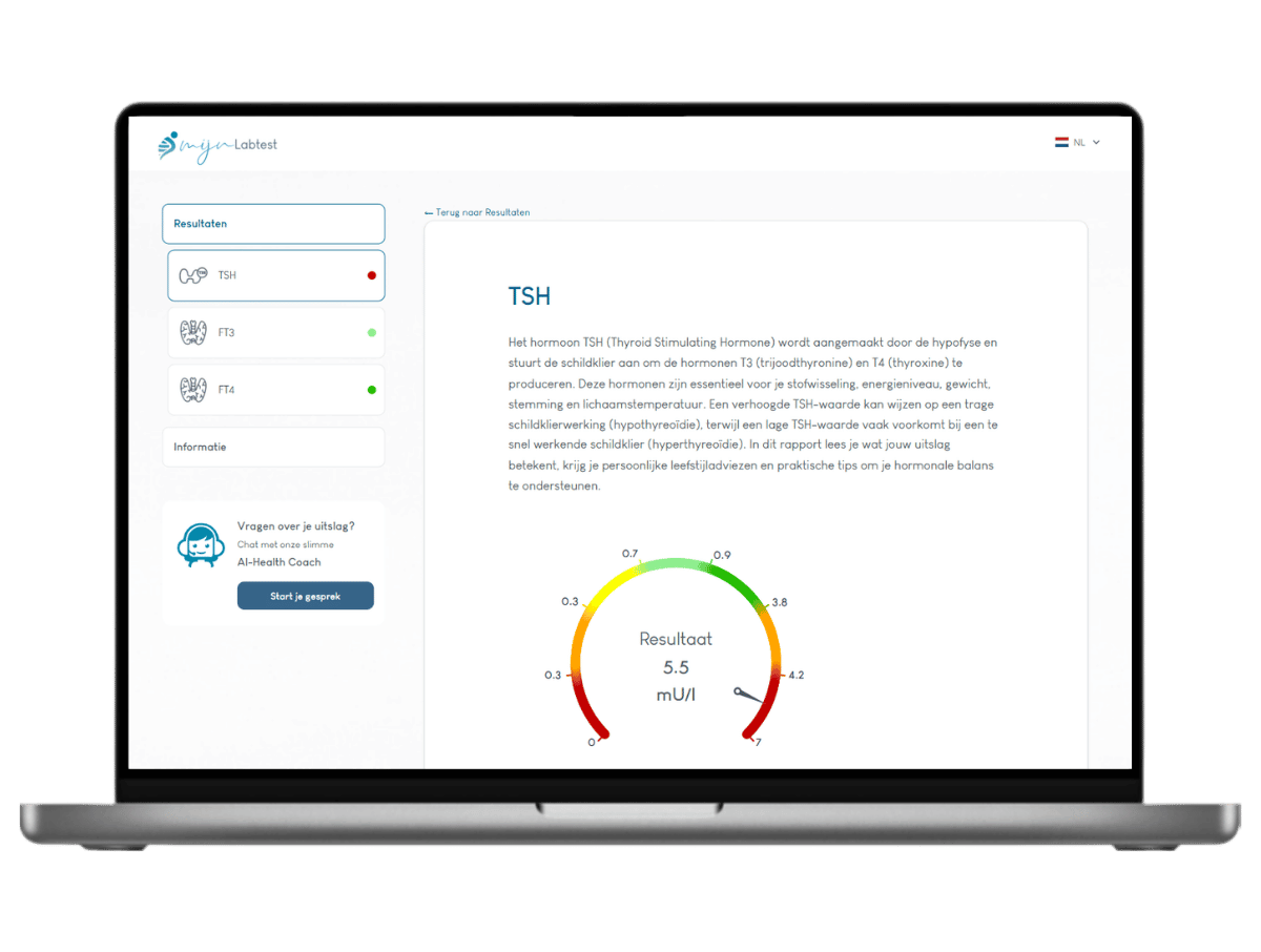 Het meest complete rapport met AI integratie en leefstijl advies. Het meest complete rapport met AI integratie en leefstijl advies.