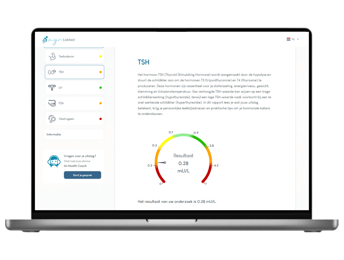 Jouw TSH resultaat. onderdeel van PCOS test van Mijnlabtest Jouw TSH resultaat. onderdeel van PCOS test van Mijnlabtest