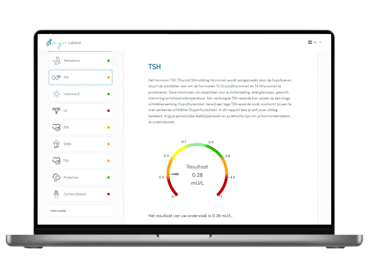 TSH test uitslag, onderdeel van hormoon test man