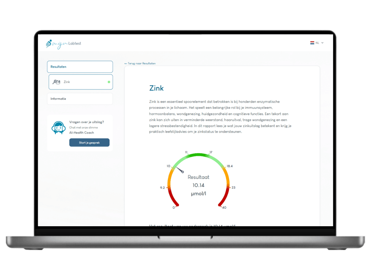 Ai integratie inclusief leefstijl advies. Ai integratie inclusief leefstijl advies.