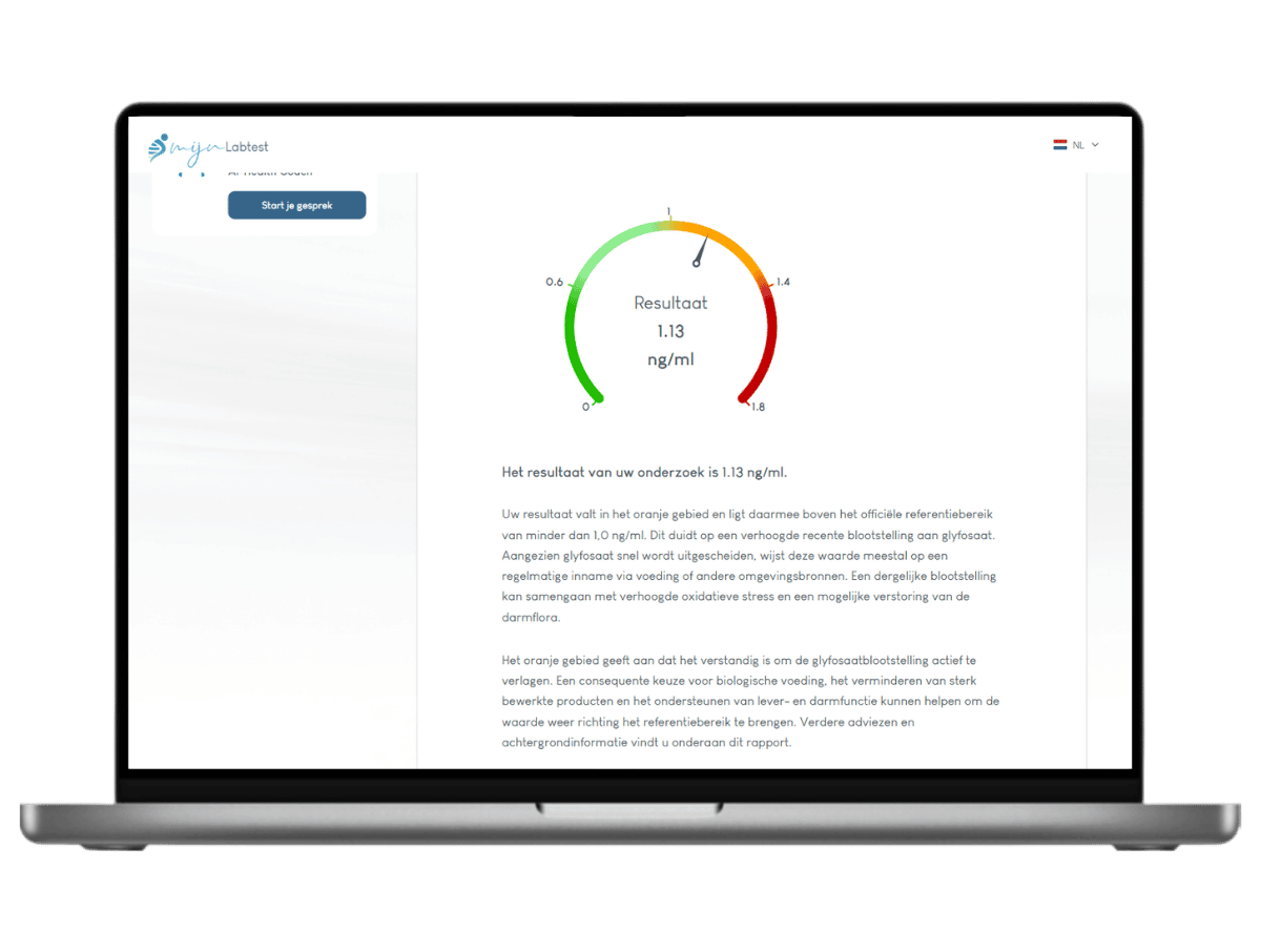Uitgebreide informatie over jouw persoonlijk resultaat. inclusief leefstijl advies en AI intergratie Uitgebreide informatie over jouw persoonlijk resultaat. inclusief leefstijl advies en AI intergratie