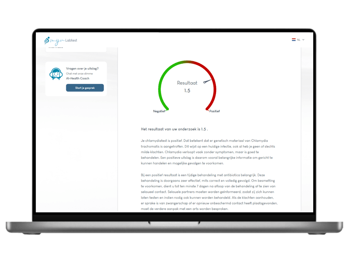 Verdieping van jouw chlamydia resultaat. binnen 5 dagen beveiligd in jouw mailbox