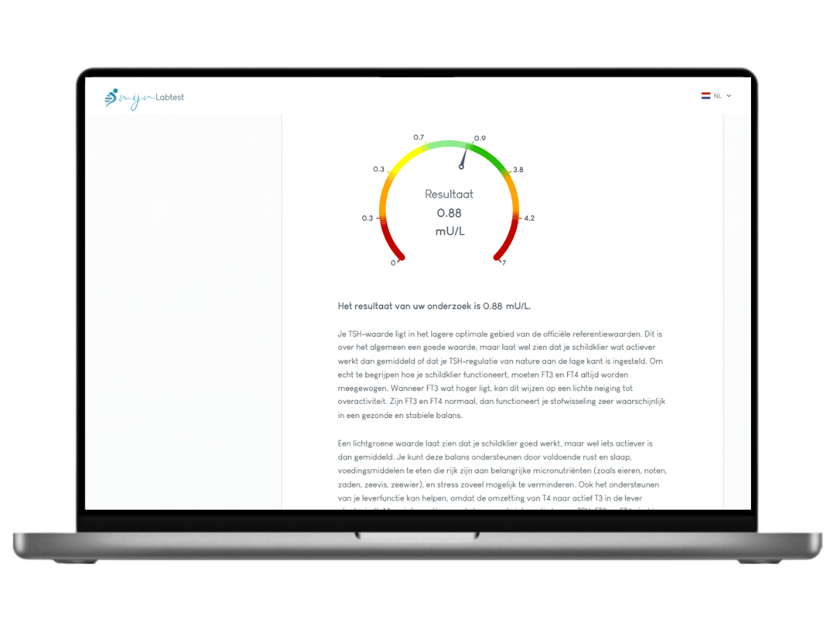 Resultaat tekst van jouw TSH schildklier test.
