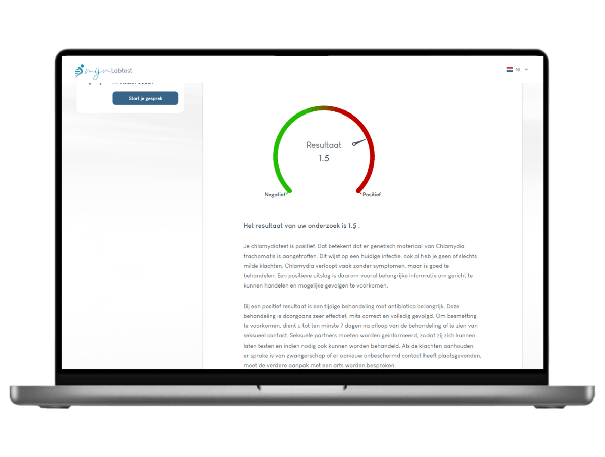 Resultaat verdieping Chlamydia test Resultaat verdieping Chlamydia test