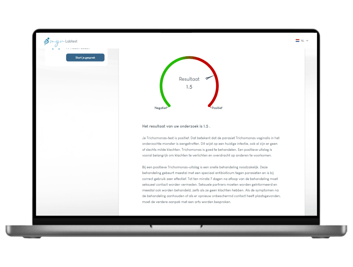 Leefstijl advies Trichomonas test